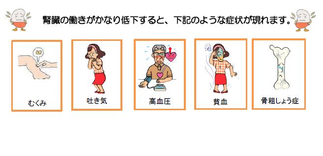 （イラスト）腎臓の働きが低下したときの症状：むくみ、吐き気、高血圧、貧血、骨粗しょう症